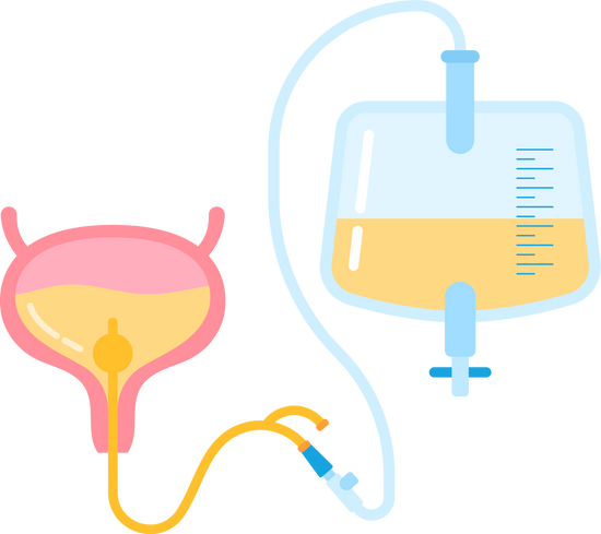 Dauerkatheter 
Canvas